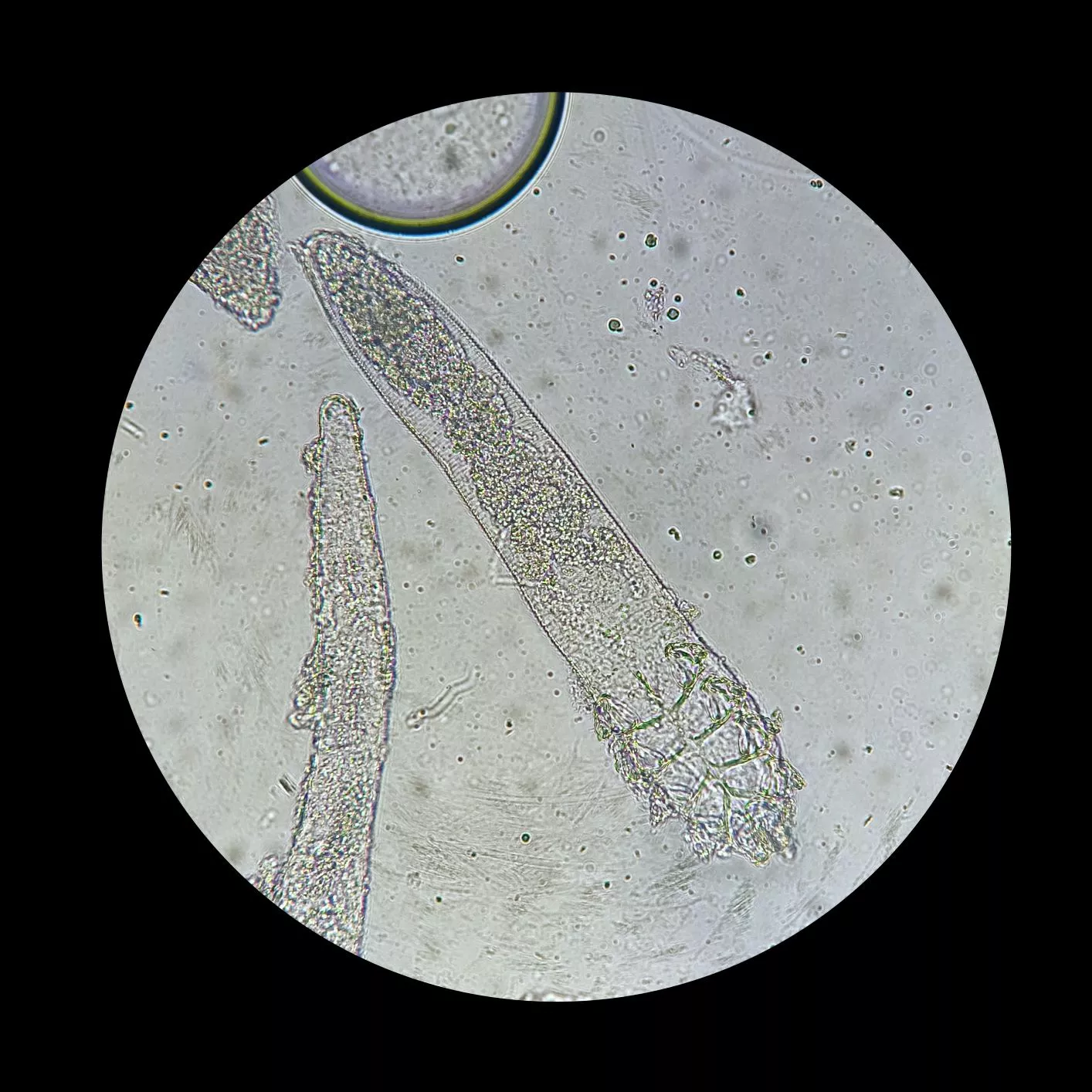 Acarieni demodex vizibili la microscop